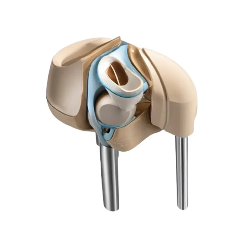 Arthritis Knee Replacement